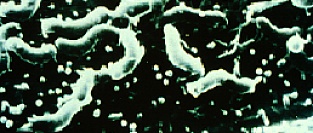 Хеликобактер пилори (Helicobacter pylori). Информация для пациентов